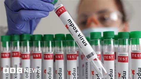time zone nigeria|Mpox: Thailand confirms Clade 1b strain for first time in Asia .